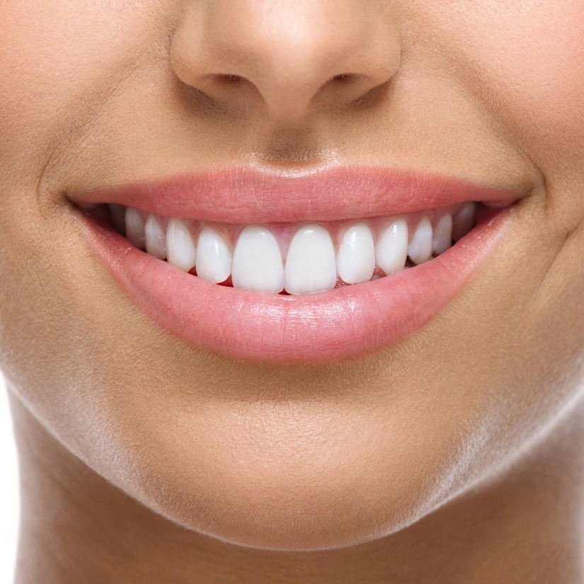 Closeup of flawless smile after makeover